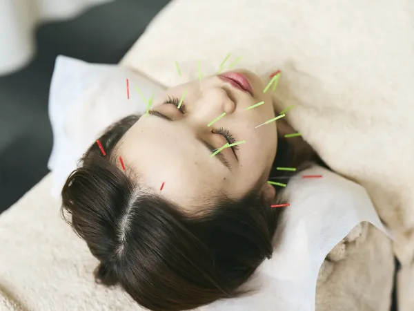 美容鍼灸